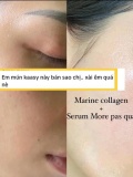 Sạch Mụn, Mờ Thâm, Phục Hồi Da Siêu Nhạy Cảm Serum More Pas Qua 1